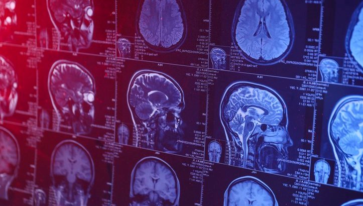 insan beyninin en verimli oldugu yas belli oldu XJqd3l1F.jpg